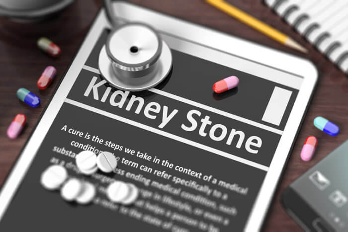 Tablet with kidney stone on its screen surrounded by medicine.