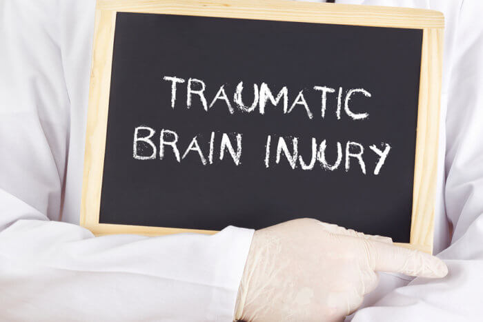 Traumatic Brain Injury written on the board held by the doctor.