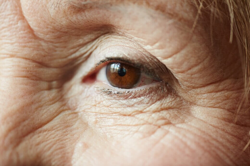 Senior eye diseases